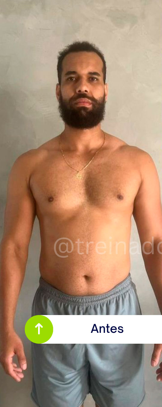 Antes - Caso 02