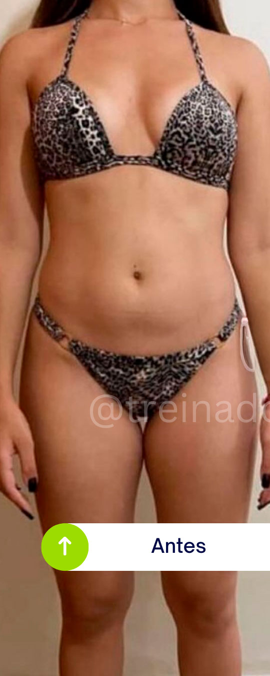 Antes - Caso 03